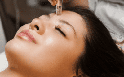 Formation microneedling en ligne